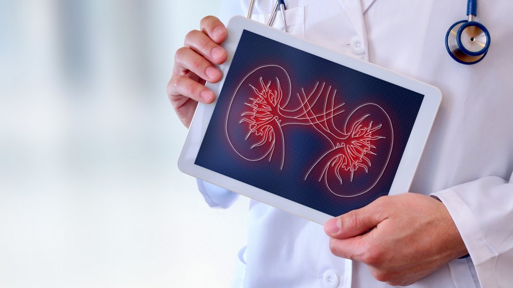 A doctor holding an illustration of kidneys