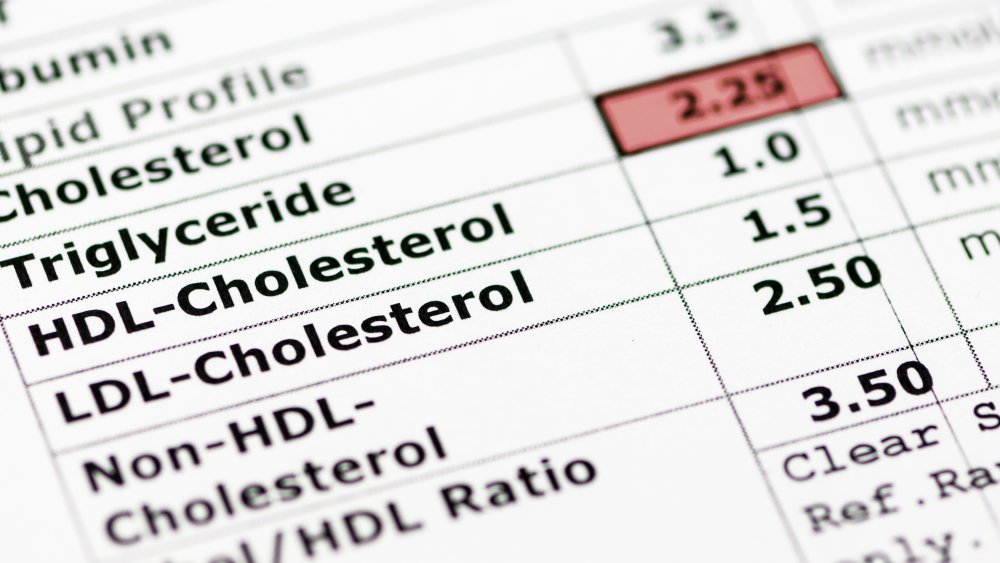 A paper showing blood test results