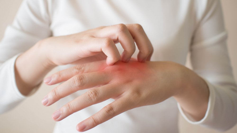 Woman scratching her hand