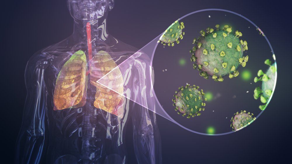 COVID-19 or coronavirus