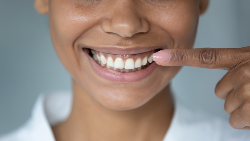 Smiling woman pointing to teeth