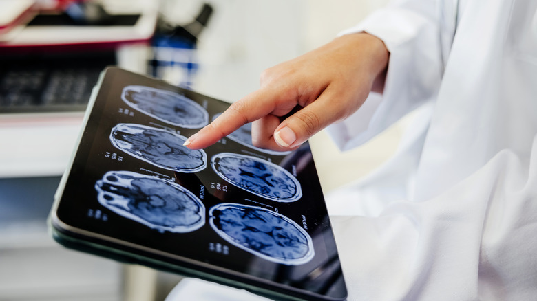 Doctor looking at brain scans on iPad