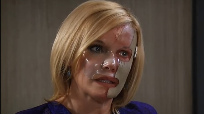 Ava Jerome wearing a transparent facial orthosis