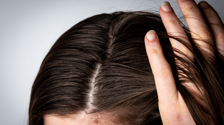 woman's parted hair and scalp