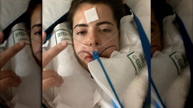 Brielle Biermann after jaw surgery