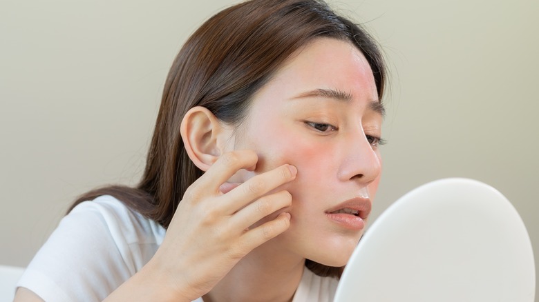 Woman checking out her dry, red skin