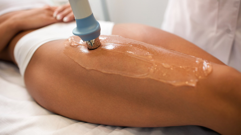 Cellulite removal procedure