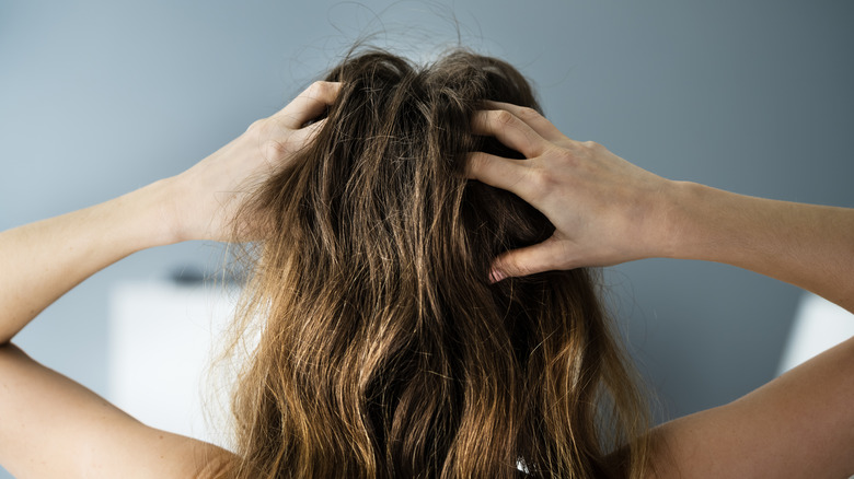 Woman with dandruff