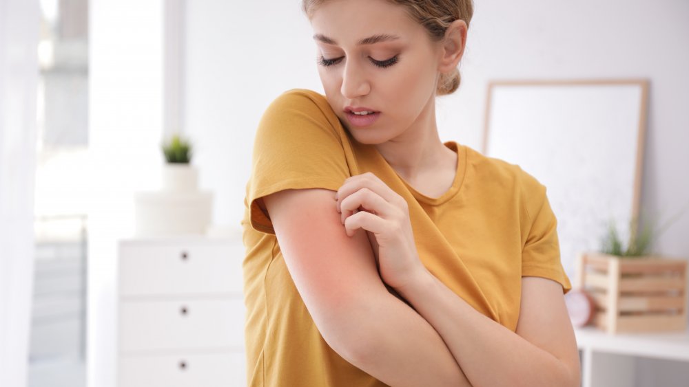 woman with itchy skin