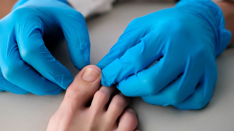 Doctor checking toenails