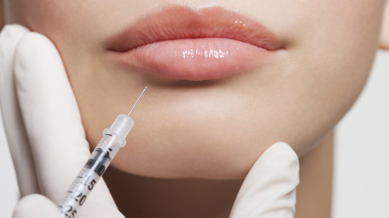 woman receiving lip injections