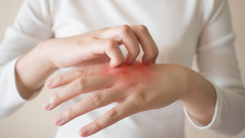 A person scratching a red patch on their hand