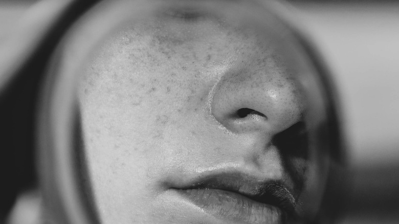 woman examining freckles in mirror